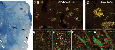 Chondroitin Sulphate Proteoglycan Axonal Coats in the Human Mediodorsal Thalamic Nucleus